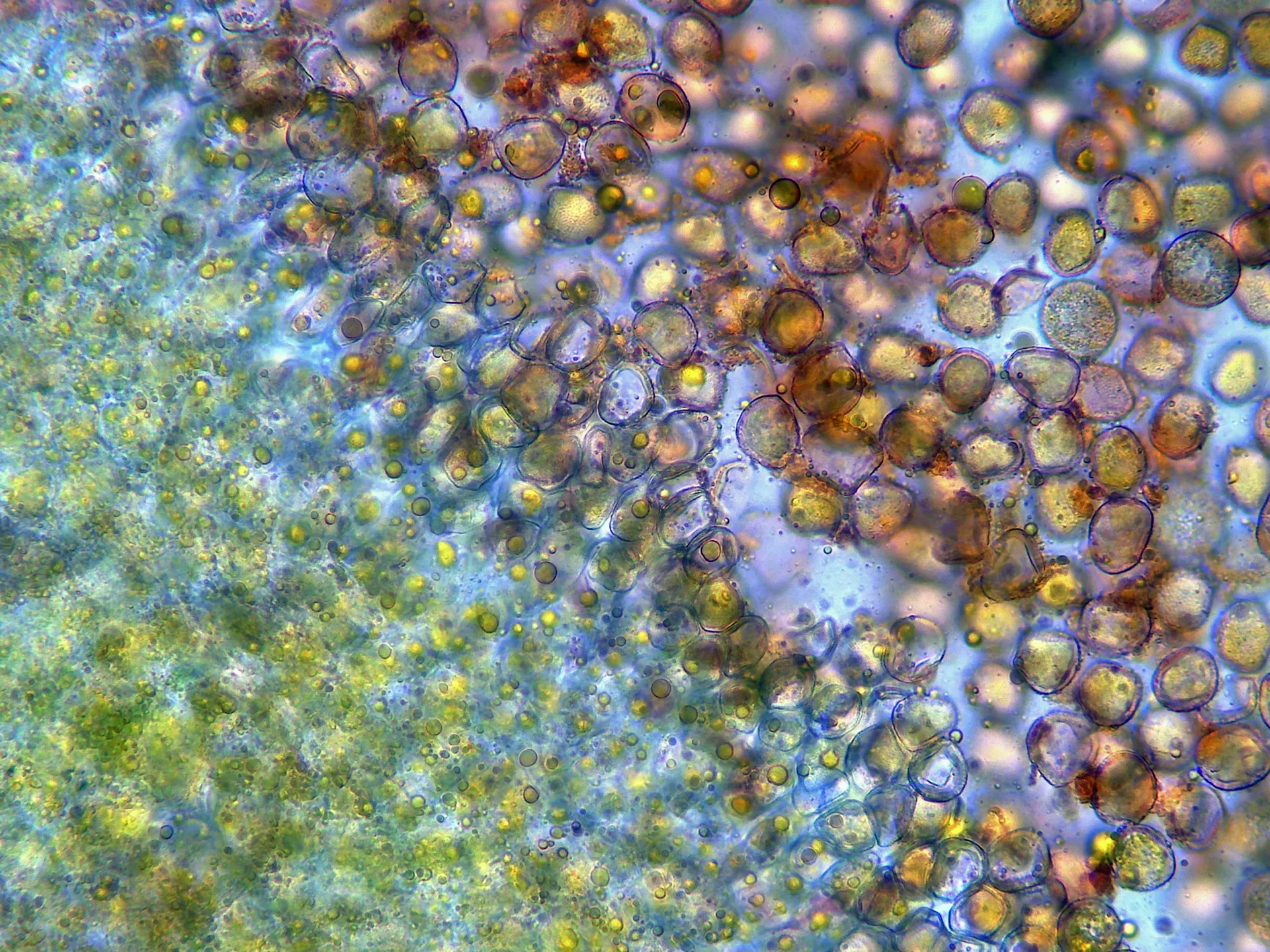 Microscopía de Melampsora pulcherrima - 12 - x 400-002